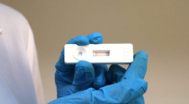 ÇOMÜ'de 8 dakikada koronavirüs tanısı koyan kit geliştirildi
