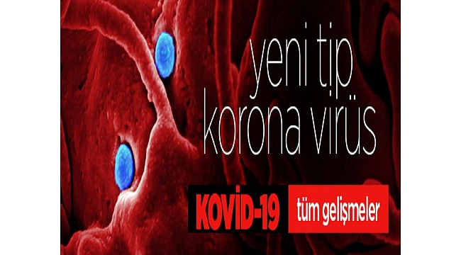 Türkiye'de son 24 saatte 1761 kişiye Kovid-19 tanısı konuldu