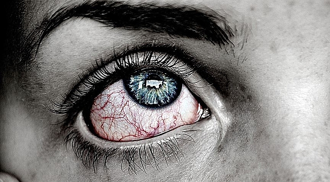 Koronavirüs belirtileri gözlerde de görülebiliyor