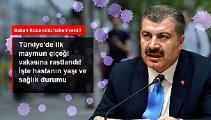 Bakan Koca kötü haberi verdi! Türkiye'de ilk maymun çiçeği vakasına rastlandı