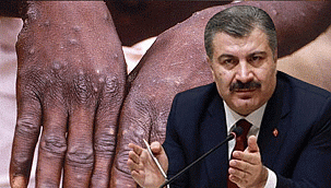  Sağlık Bakanı Fahrettin Koca: Türkiye'de 5 maymun çiçeği vakası tespit edildi