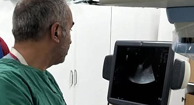 ÇOMÜ Hastanesi’nde tiroit nodüllerine ameliyatsız tedavi başarıyla yapılıyor.