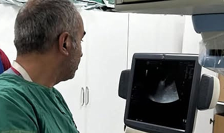 ÇOMÜ Hastanesi’nde tiroit nodüllerine ameliyatsız tedavi başarıyla yapılıyor.