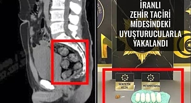 İranlı Zehir Taciri, Midesinde Uyuşturucu Taşıyarak Çanakkale'ye Geldi